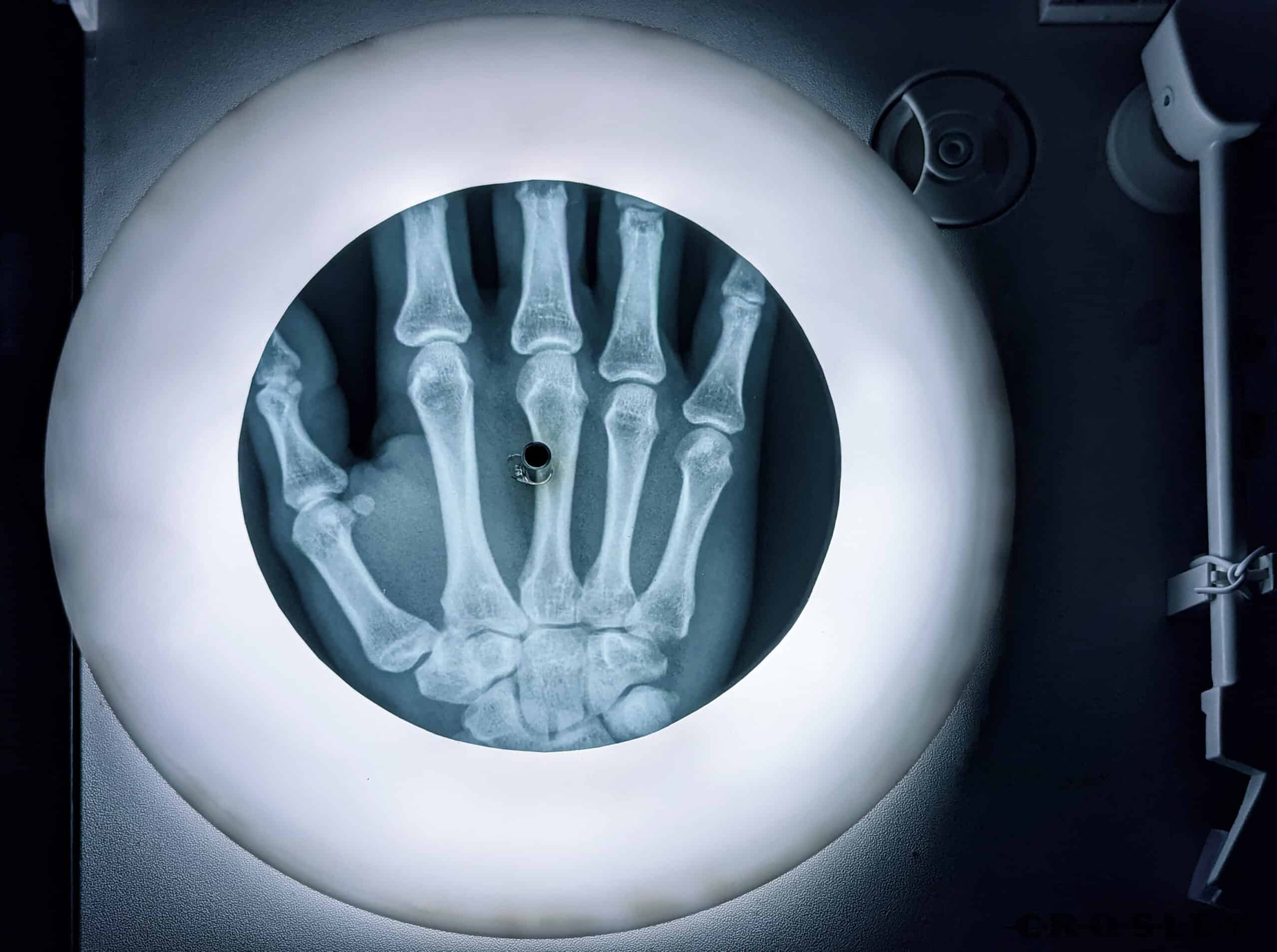 Jenny Yurshansky: Rinsing the Bones